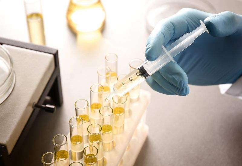 尿检能检测出来什么问题? 尿检能检测出来什么问题?